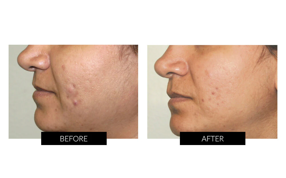 CurrentBody Skin Face, Lip & Neck Kit (worth $908) - Image 4