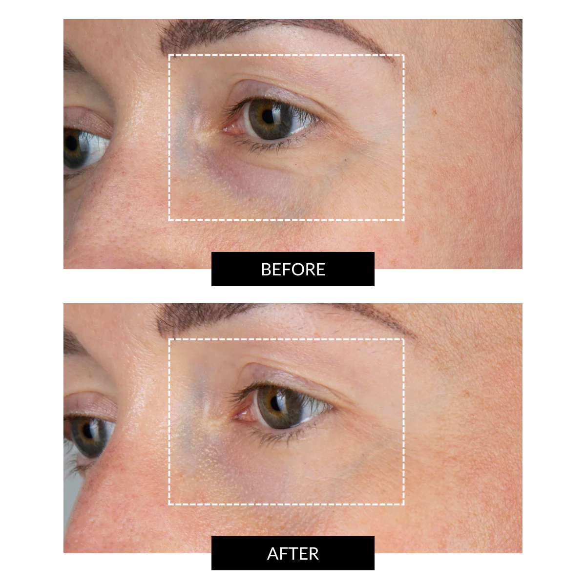 CurrentBody Skin LED Eye Perfector & 5 Eye Hydrogel Masks (worth $284) - Image 3