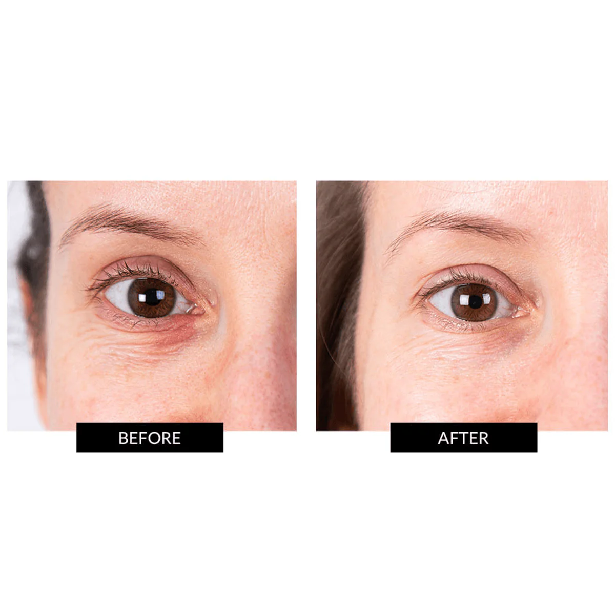 CurrentBody Skin LED Eye Perfector & 5 Eye Hydrogel Masks (worth $284) - Image 5